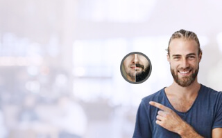 beard transplant before and after
